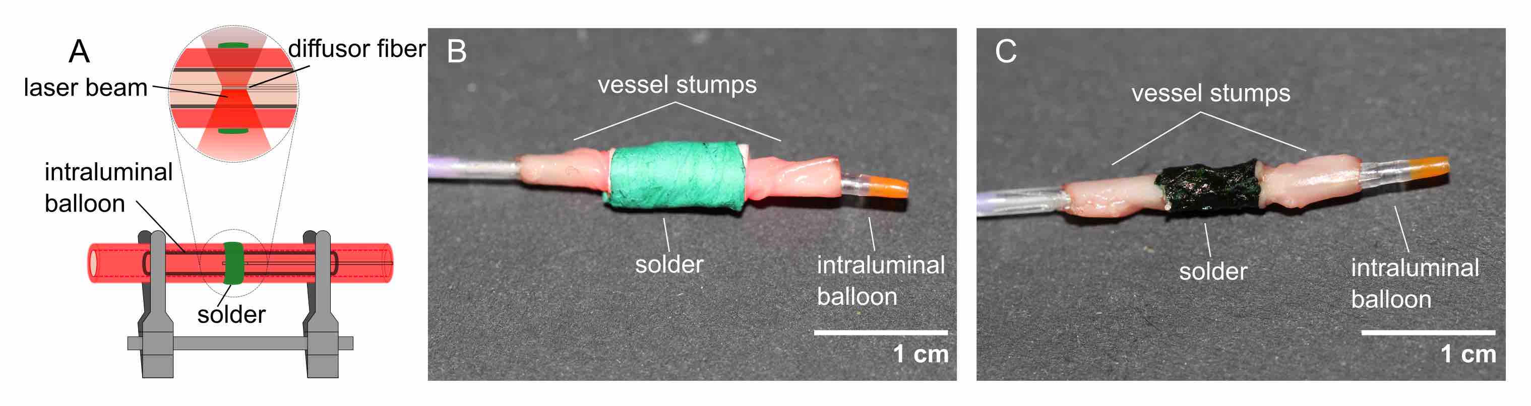 A: Sketch of end-to-end anastomosis of blood vessels using LTS. B: Setup for ex-vivo experiment showing the alignment of the vessel ends using a balloon catheter, and the patch wrapped around the vessel. C: Vessel after irradiation.