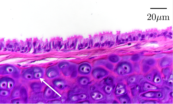 Columnar respiratory epithelium from a trachea of a BIBD-infected boa constrictor