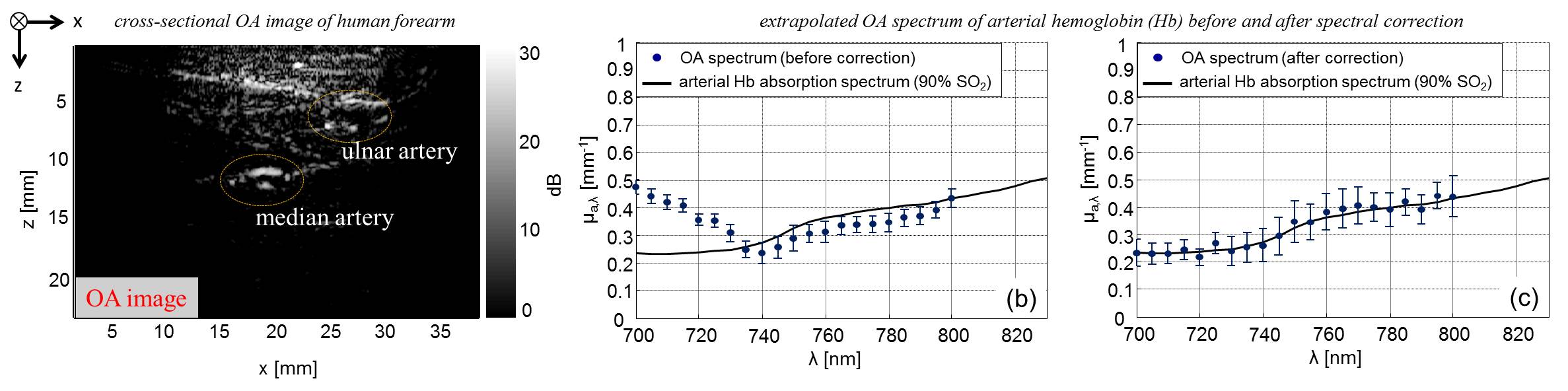 other abnormalities characterized by a change in tissue oxygenation or perfusion status