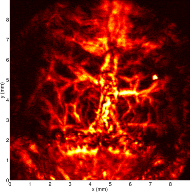 Optoacoustic (OA) Microscopy is a promising non-invasive medical imaging technique